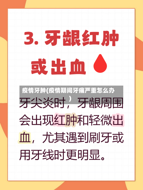 疫情牙肿(疫情期间牙痛严重怎么办)-第3张图片