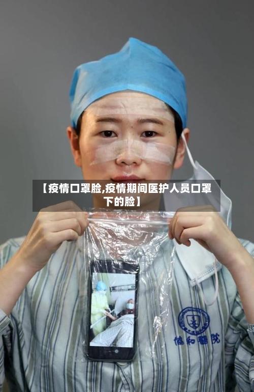 【疫情口罩脸,疫情期间医护人员口罩下的脸】-第1张图片